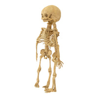 Antique 19th Century French Anatomical Conjoined Syncephalus Twins Skeleton Medical Model 1860