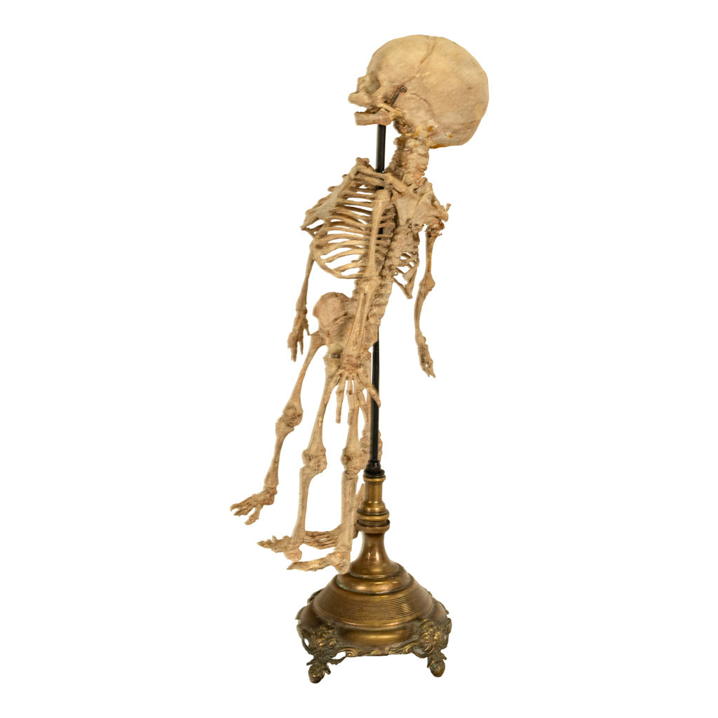 Antique 19th Century French Anatomical Conjoined Syncephalus Twins Skeleton Medical Model 1860