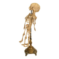 Antique 19th Century French Anatomical Conjoined Syncephalus Twins Skeleton Medical Model 1860
