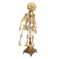 Antique 19th Century French Anatomical Conjoined Syncephalus Twins Skeleton Medical Model 1860