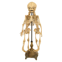 Antique 19th Century French Anatomical Conjoined Syncephalus Twins Skeleton Medical Model 1860