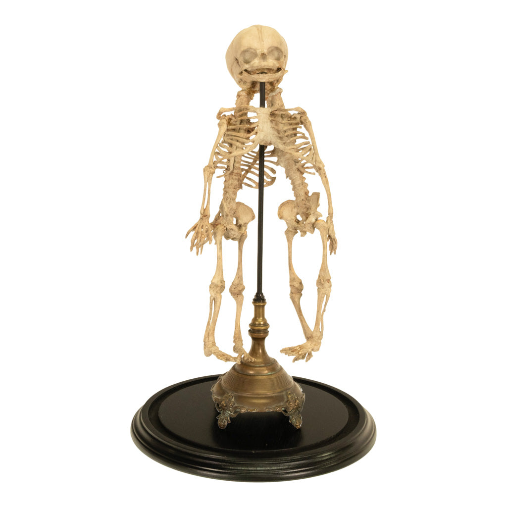 Antique 19th Century French Anatomical Conjoined Syncephalus Twins Skeleton Medical Model 1860