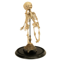 Antique 19th Century French Anatomical Conjoined Syncephalus Twins Skeleton Medical Model 1860