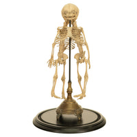Antique 19th Century French Anatomical Conjoined Syncephalus Twins Skeleton Medical Model 1860