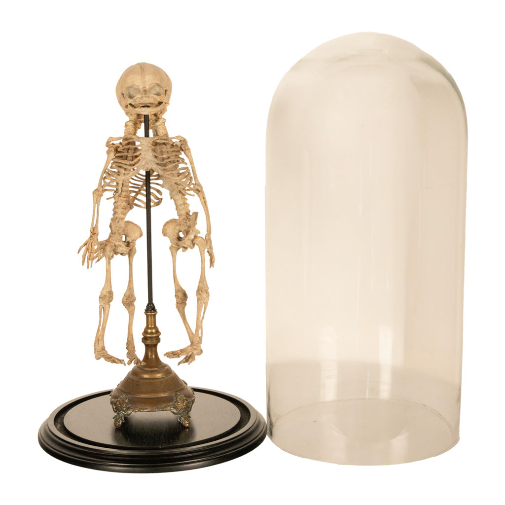 Antique 19th Century French Anatomical Conjoined Syncephalus Twins Skeleton Medical Model 1860