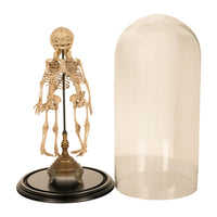 Antique 19th Century French Anatomical Conjoined Syncephalus Twins Skeleton Medical Model 1860