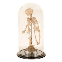 Antique 19th Century French Anatomical Conjoined Syncephalus Twins Skeleton Medical Model 1860