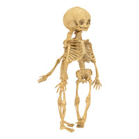 Antique 19th Century French Anatomical Conjoined Syncephalus Twins Skeleton Medical Model 1860
