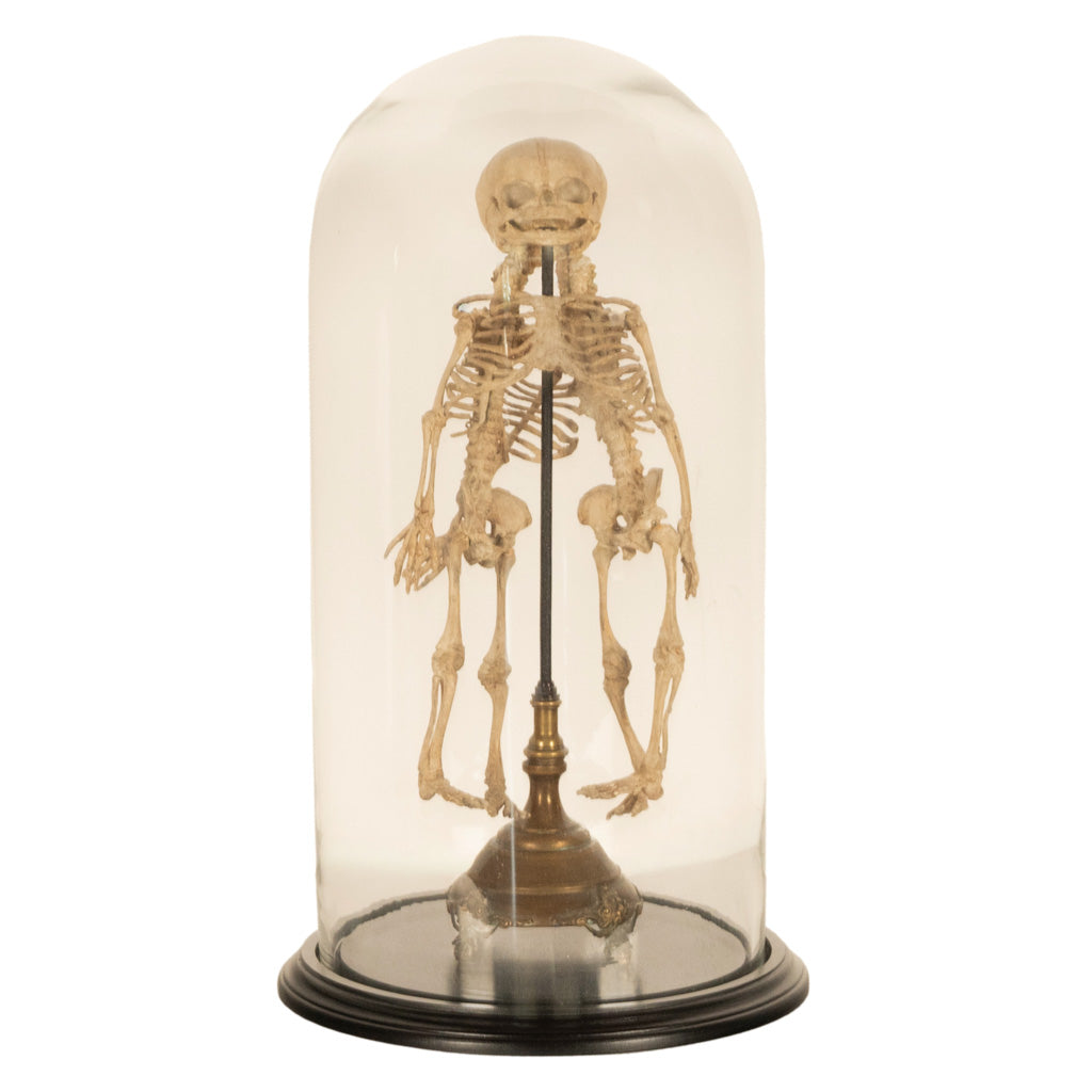 Antique 19th Century French Anatomical Conjoined Syncephalus Twins Skeleton Medical Model 1860