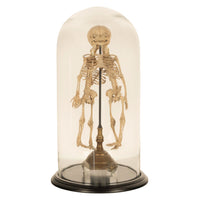 Antique 19th Century French Anatomical Conjoined Syncephalus Twins Skeleton Medical Model 1860
