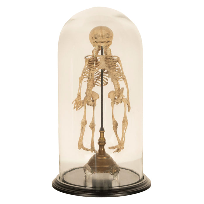 Antique 19th Century French Anatomical Conjoined Syncephalus Twins Skeleton Medical Model 1860