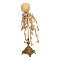 Antique 19th Century French Anatomical Conjoined Syncephalus Twins Skeleton Medical Model 1860