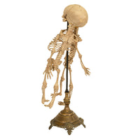 Antique 19th Century French Anatomical Conjoined Syncephalus Twins Skeleton Medical Model 1860